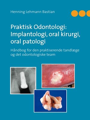 cover image of Praktisk Odontologi--Implantologi, oral kirurgi, oral patologi